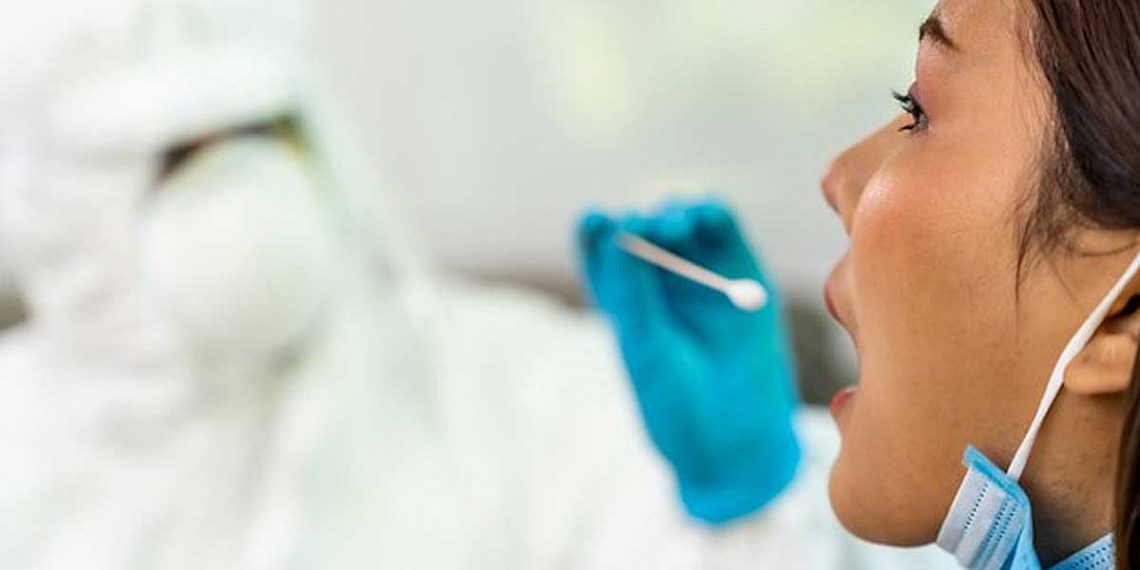 Inilah Rumah Sakit dan Laboratorium yang Melayani Rapid Test Antigen di